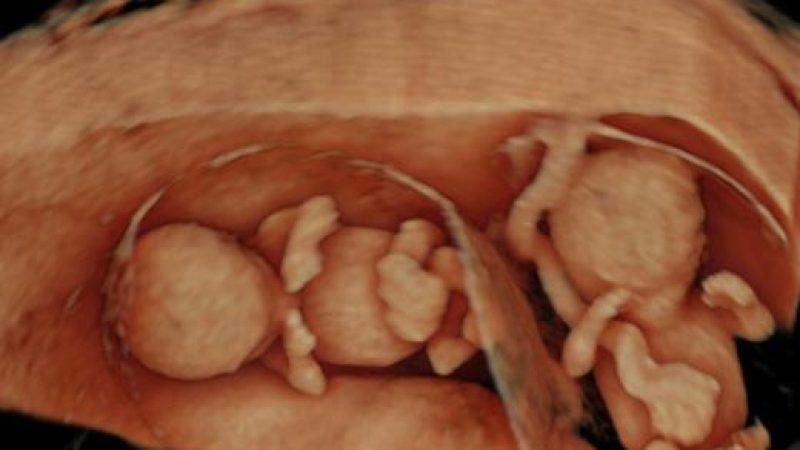 10-wks-twins-b-6312.jpg