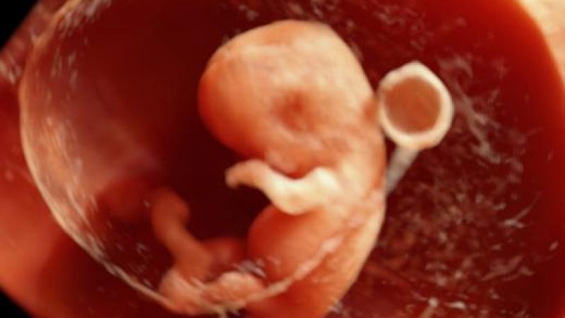 10wks-6504.jpg