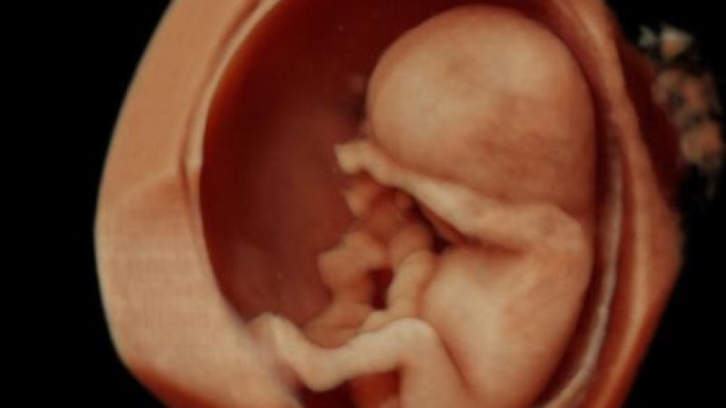 12wks-6366.jpg