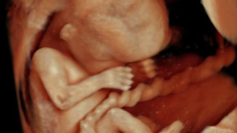 12wks-6537.jpg