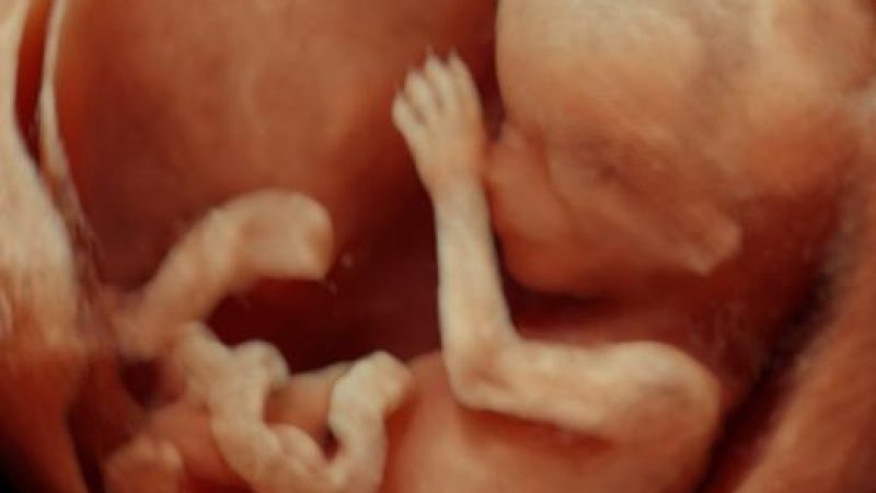 13wks-6745.jpg