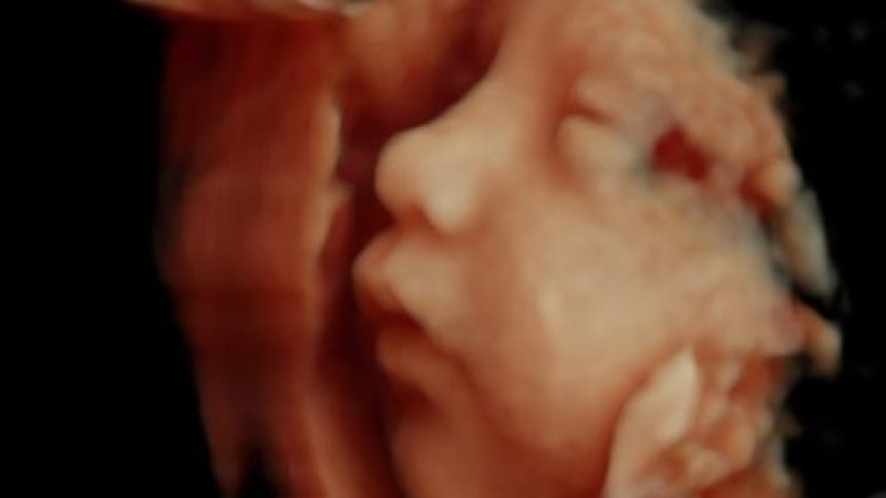 32wks-6303.jpg