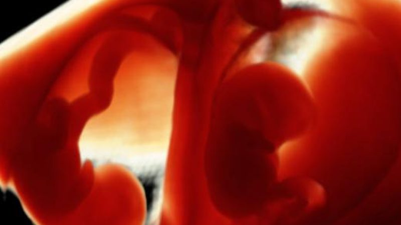 8wks-twins-6567.jpg